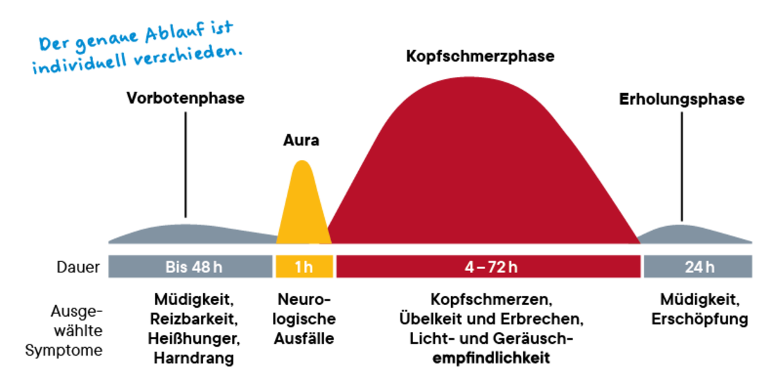 Schema der Migränephasen: Vorwarnphase (bis zu 48 Stunden, Müdigkeit, Reizbarkeit, Hunger), Aura (1 Stunde, neurologische Symptome), Kopfschmerzen (4-72 Stunden, Schmerzen, Übelkeit, Empfindlichkeit), Erholungsphase (24 Stunden, Müdigkeit, Erschöpfung).