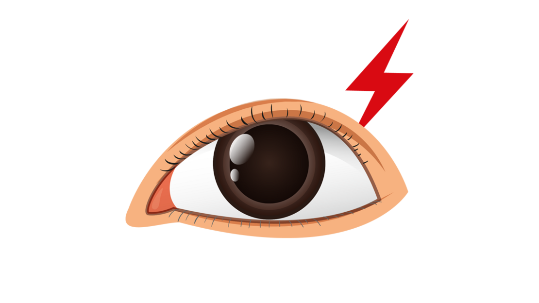Illustration Auge mit rotem Blitz